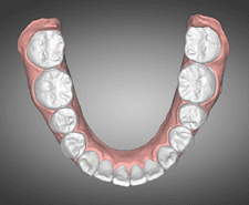 Mid-term - Mandibular occlusal