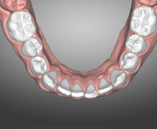 Mid-term - Mandibular occlusal
