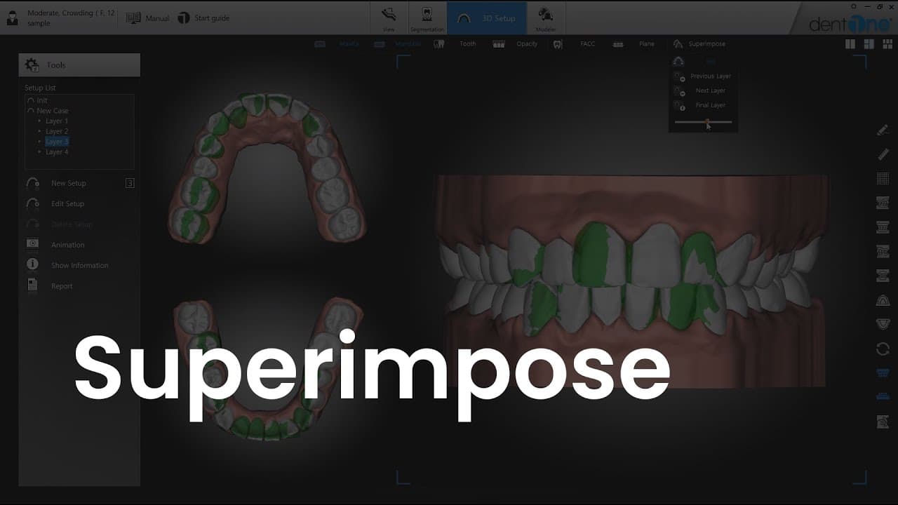 Superimpose
