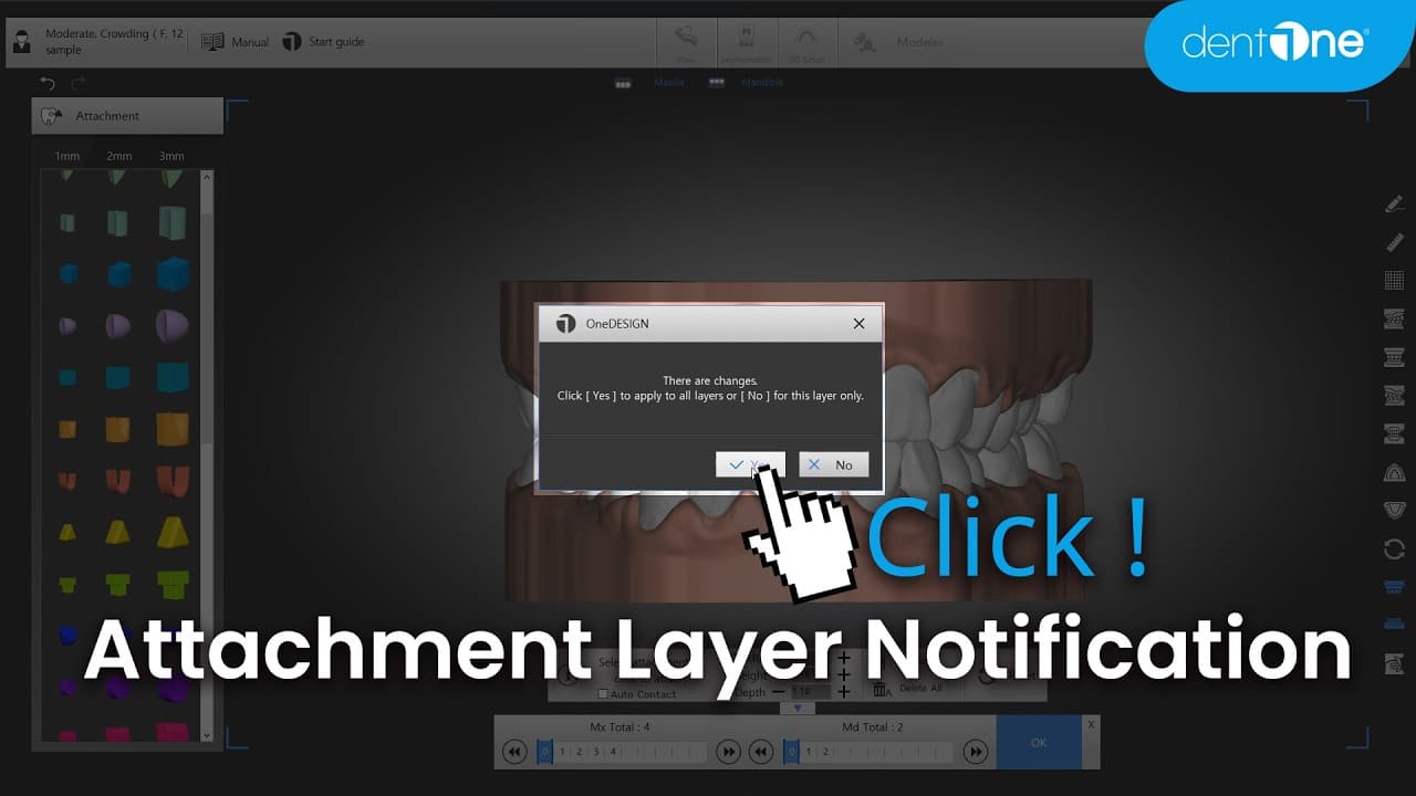 Attachment Application Range by Layer