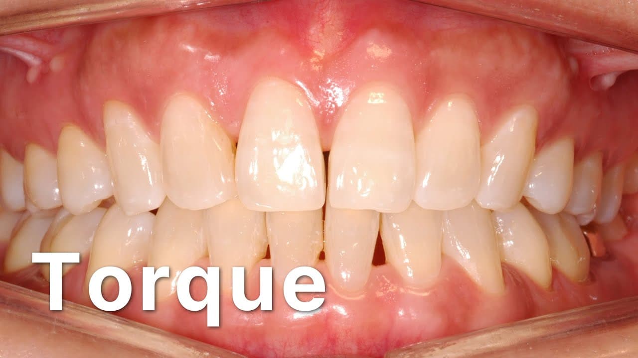 Torque