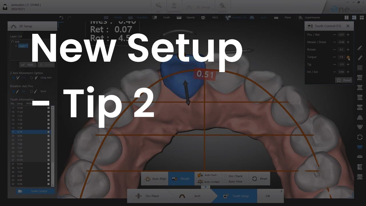 How to move / rotate teeth without rotating the screen