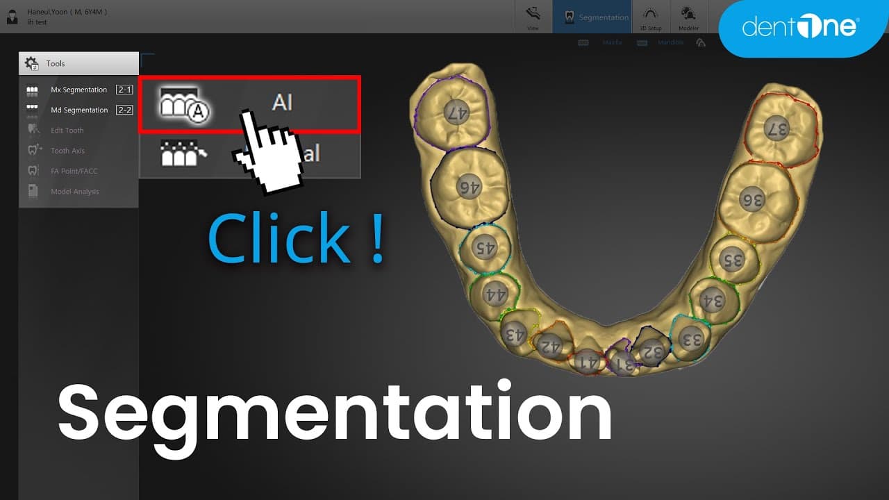Segmentation