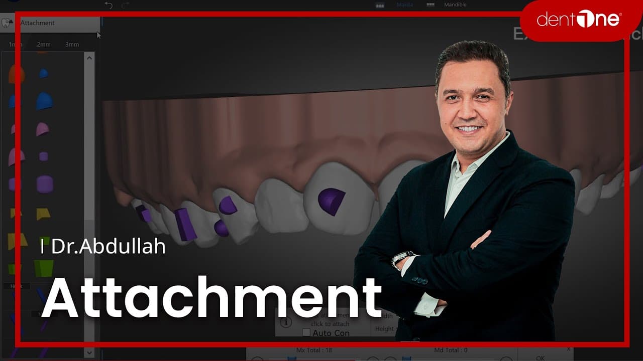 #2 Attachment