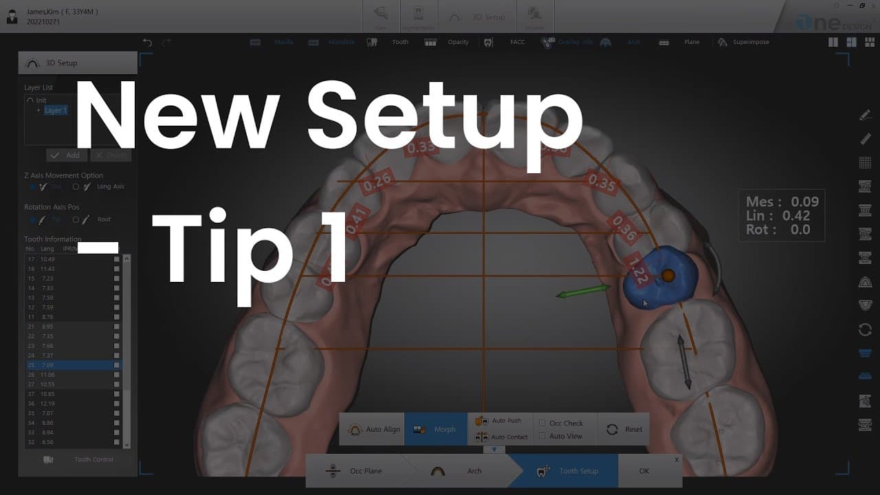 How to Setup quickly