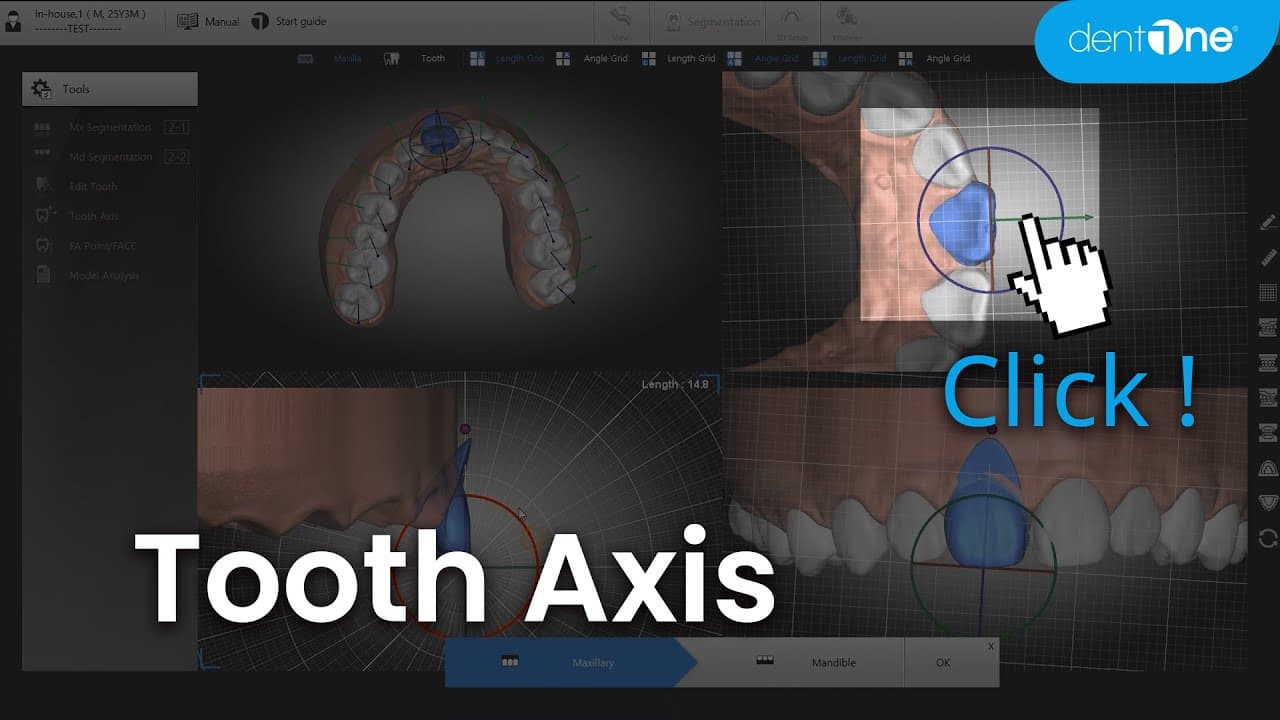 Tooth Axis