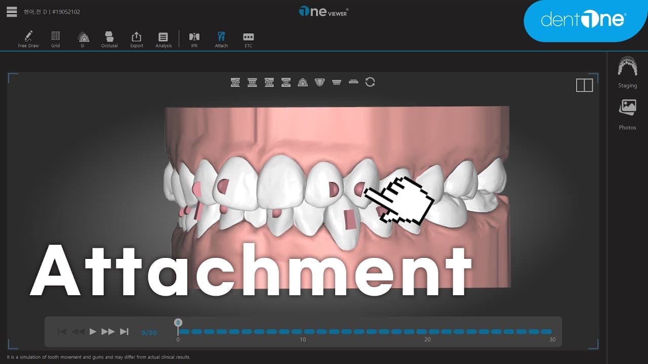 Attachment