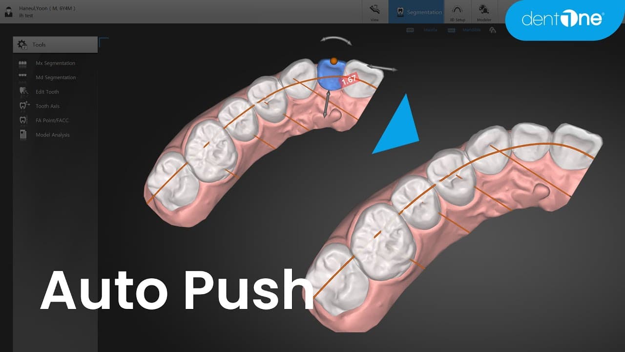 Auto Push