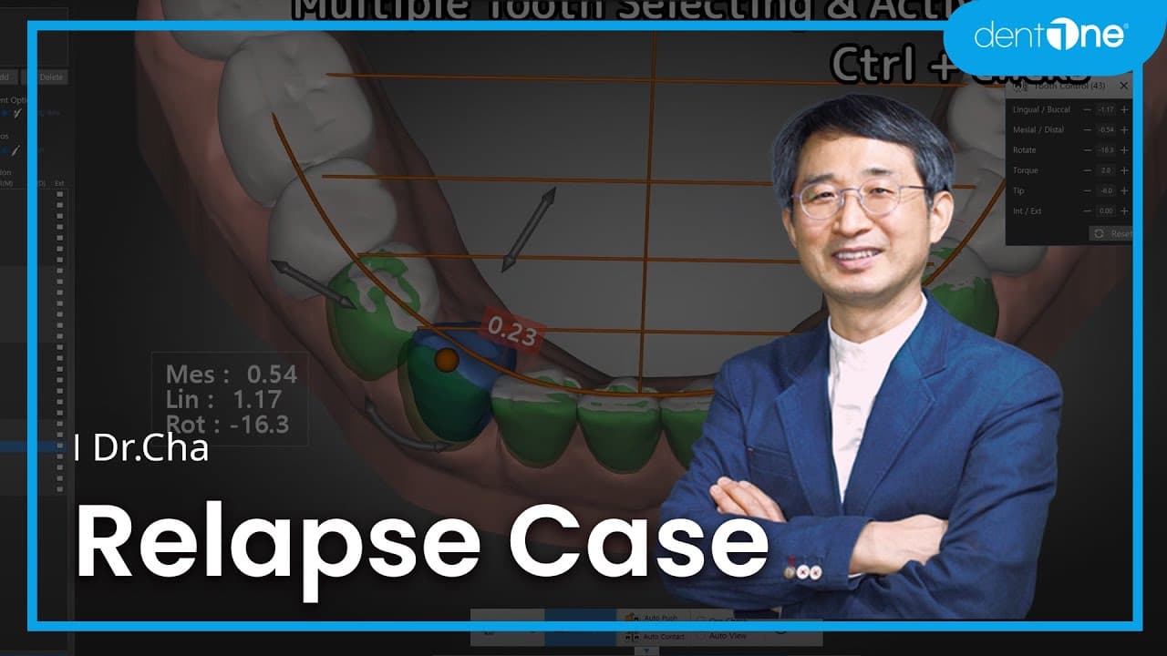 #2 Relapse Case