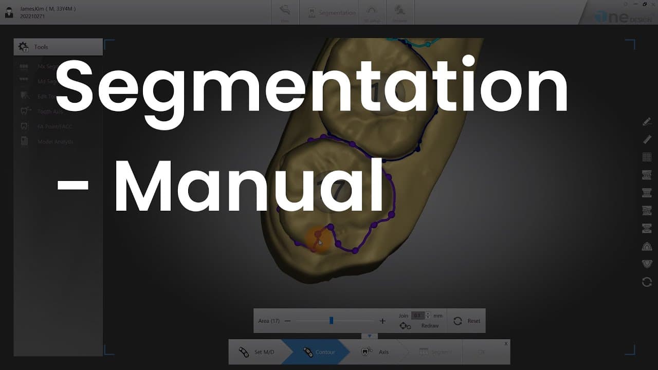 Segmentation - Manual