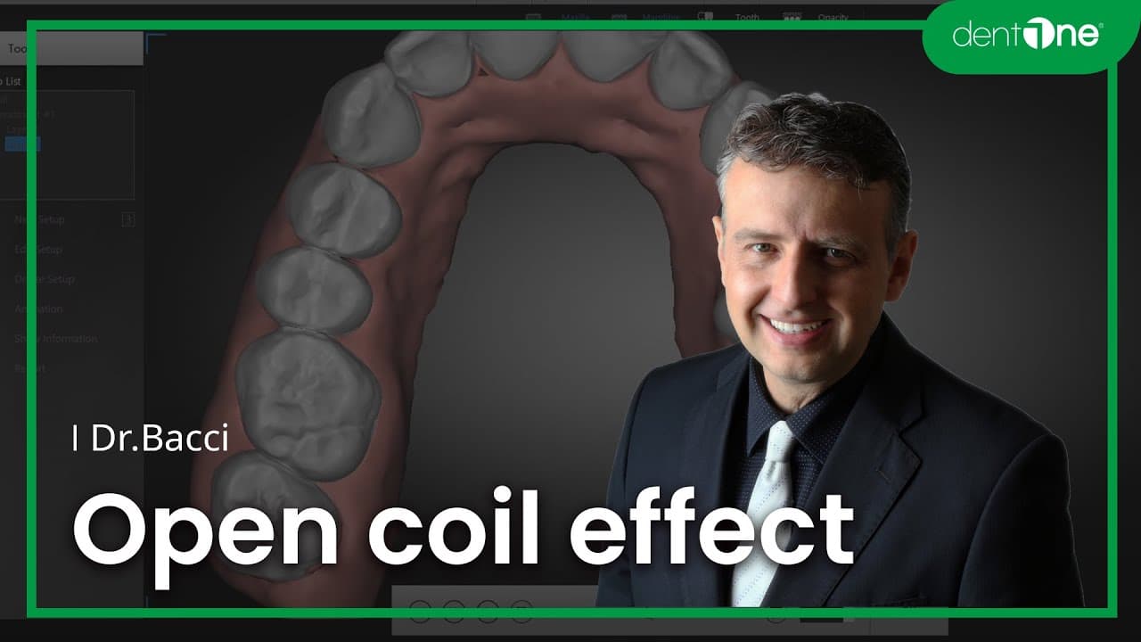 #3 Open coil effect