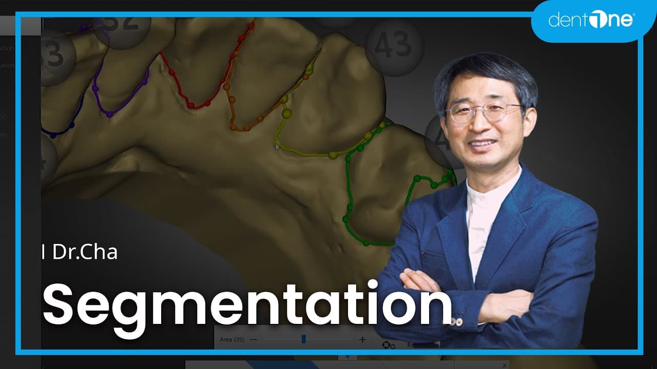 #6 Segmentation