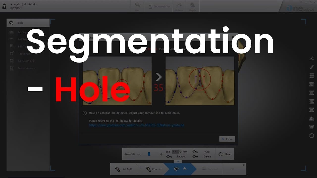 Hole message