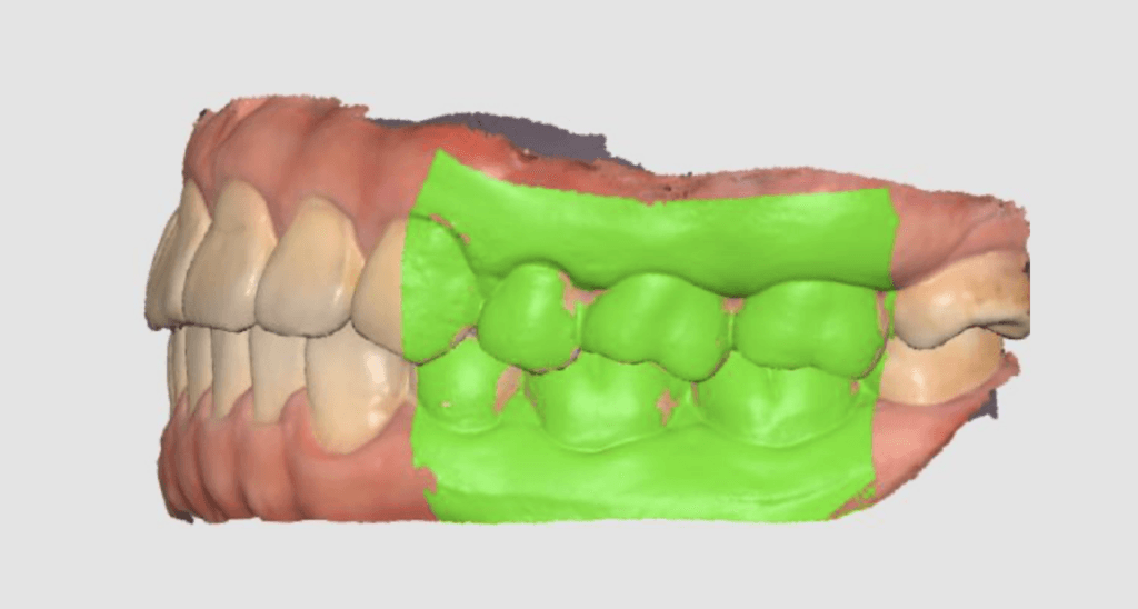 Scan data with the required area highlighted