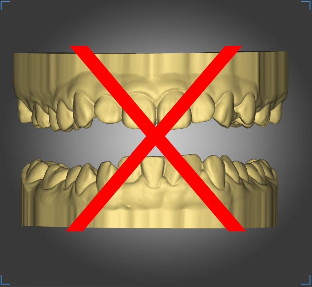 Incorrect occlusion 1