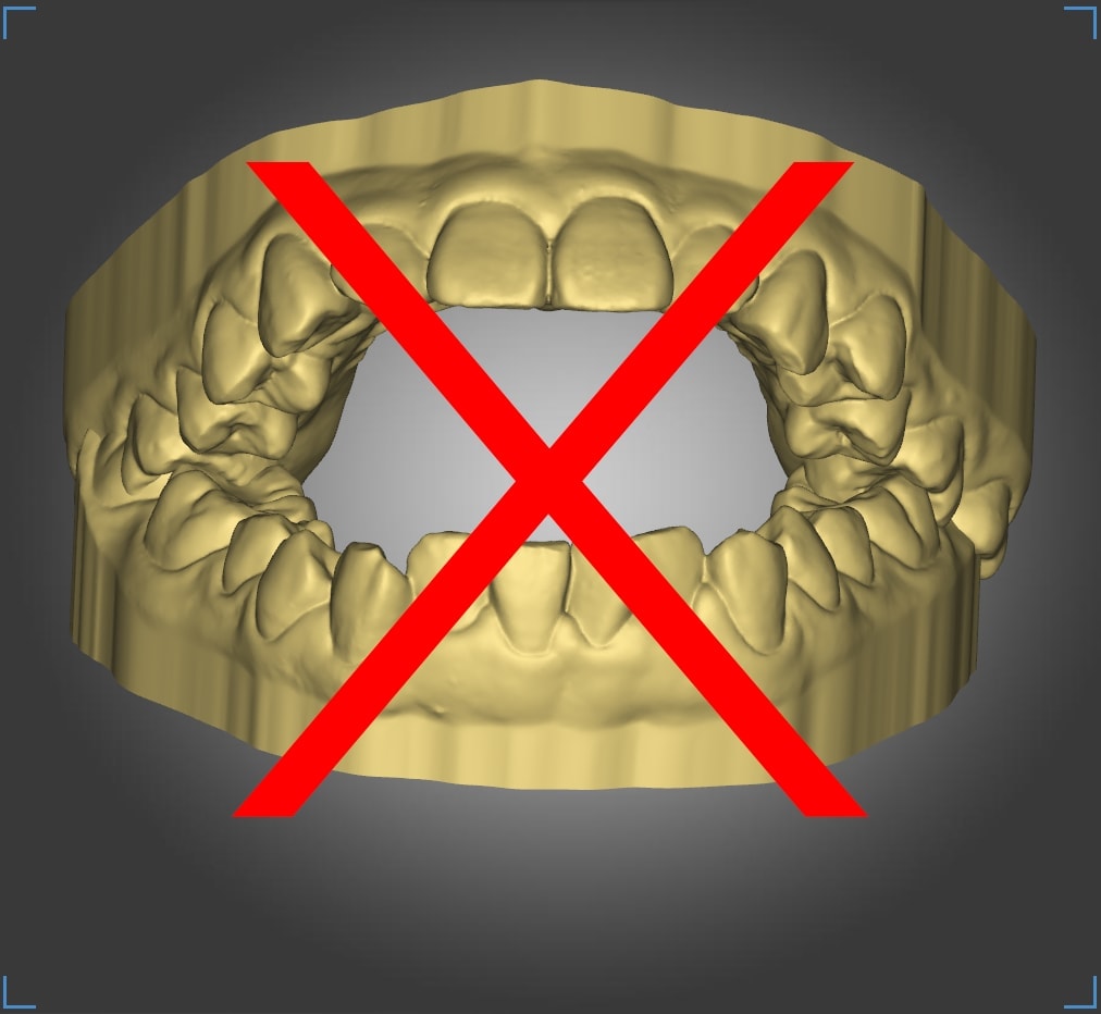 Incorrect occlusion 3