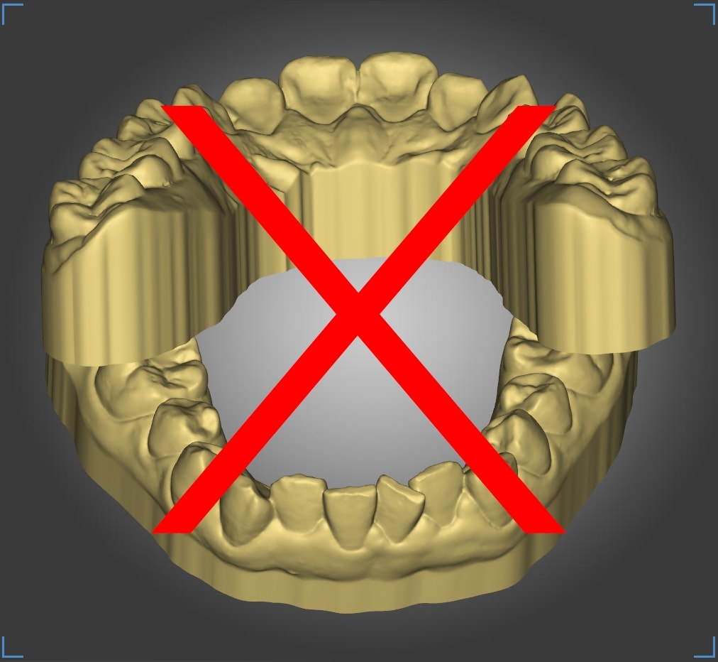 Incorrect occlusion 4