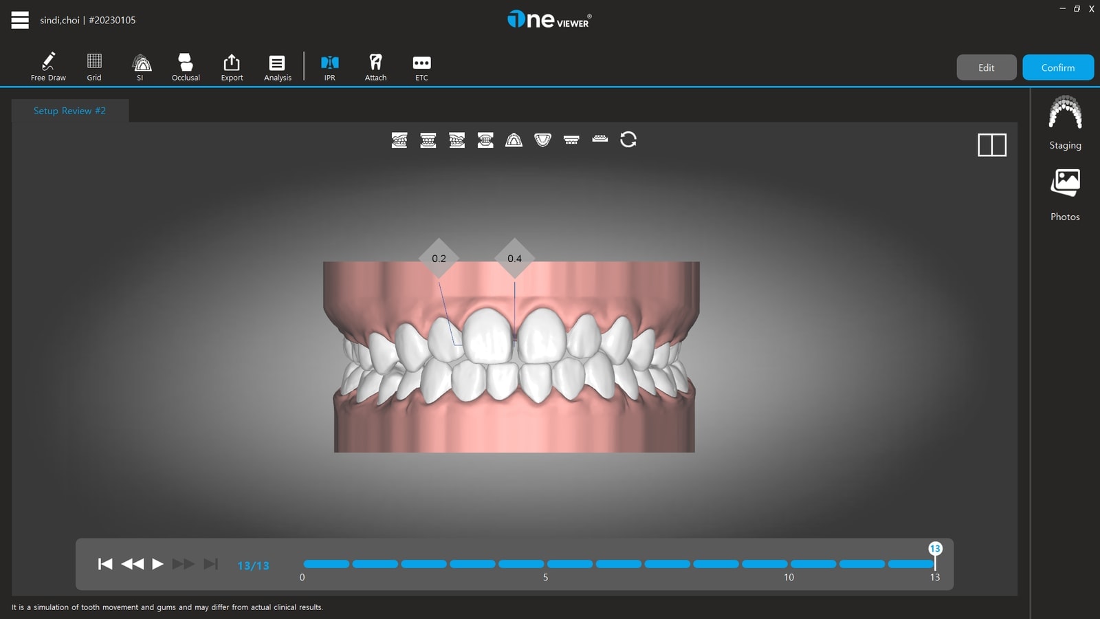 IPR screen
