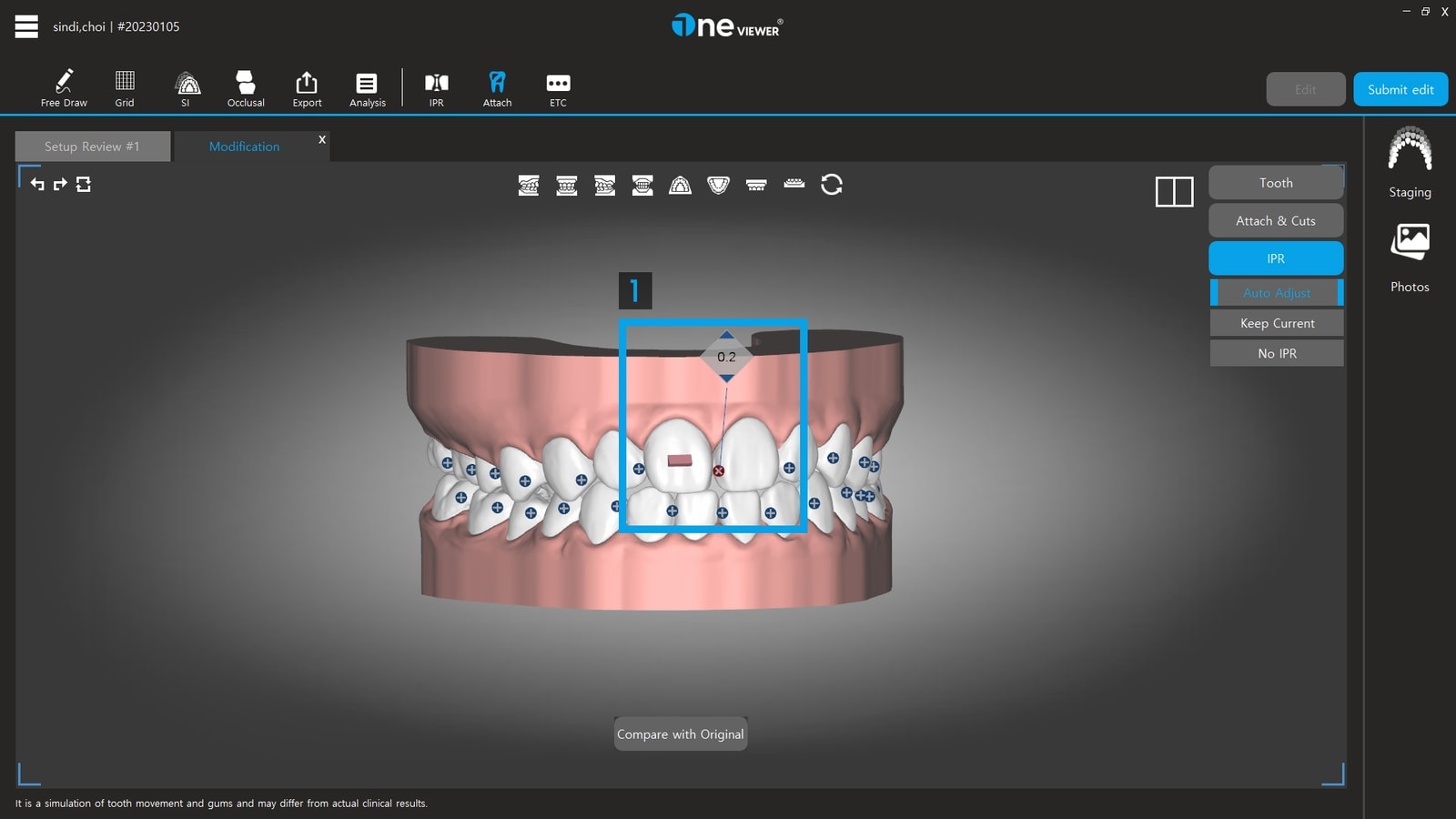 IPR edit screen