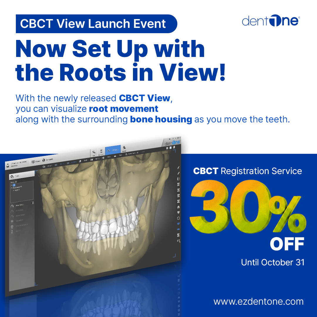 CBCT 정합 서비스 30% 할인 이벤트