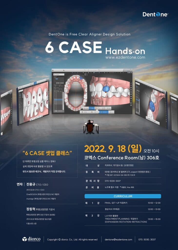 Clear aligner 6CASE_Hands-on